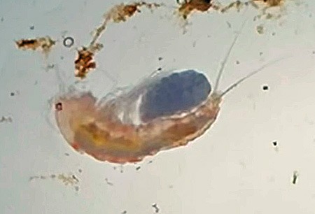 Copepod With Eggs